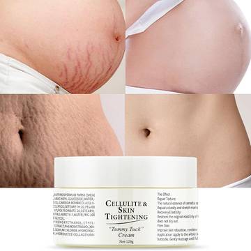 Mama Mio The Tummy Rub Stretch Mark Oil
